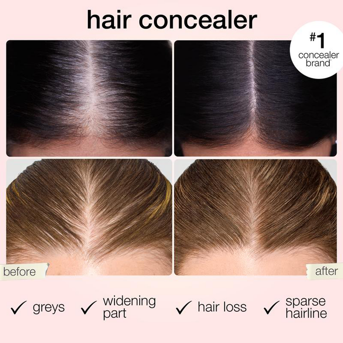 Hair Concealer – Instantly Covers Gray Roots & Thinning Hair